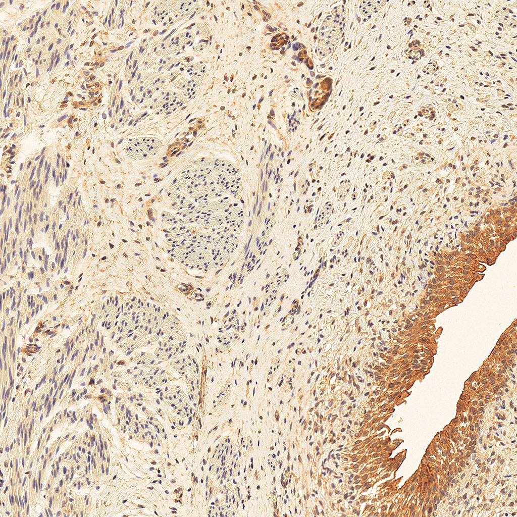 sars-cov-2 gene expression in a human fetus
